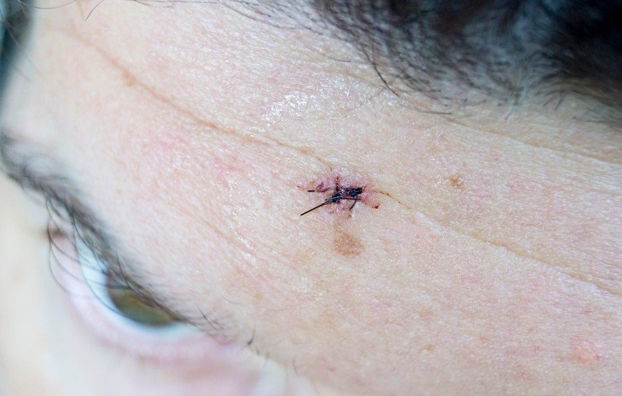 קרדיט: קנבה